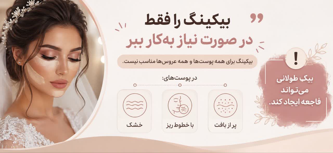 بیکینگ را فقط در صورت نیاز به‌کار ببر